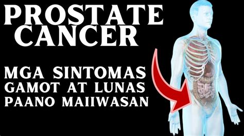ano ang ibig sabihin ng psa|Kanser sa Prostate (Prostate Cancer) .